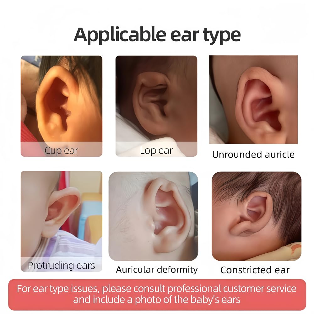 Shenzkeji silicone gel tape for cup ear provides comfortable support