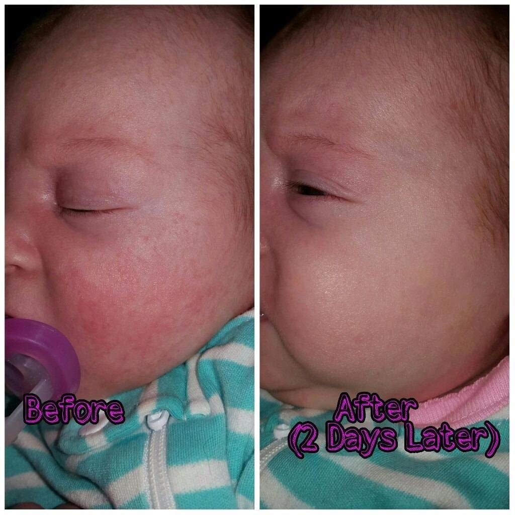 SIANI BabyBiotics baby skin close-up showing gentle texture