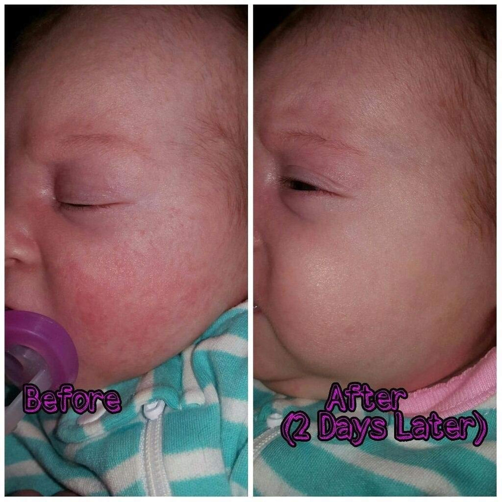 SIANI BabyBiotics baby skin close-up showing gentle texture