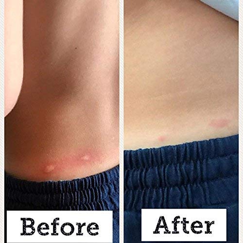 SIANI BabyBiotics good bacteria shield visual for skin support