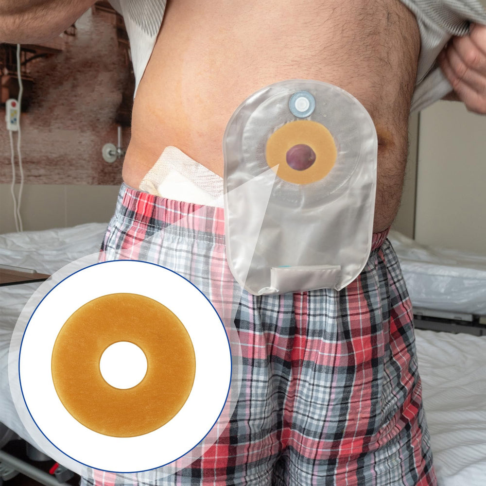 Siifert barrier ring material is body-friendly and designed to minimize irritation.