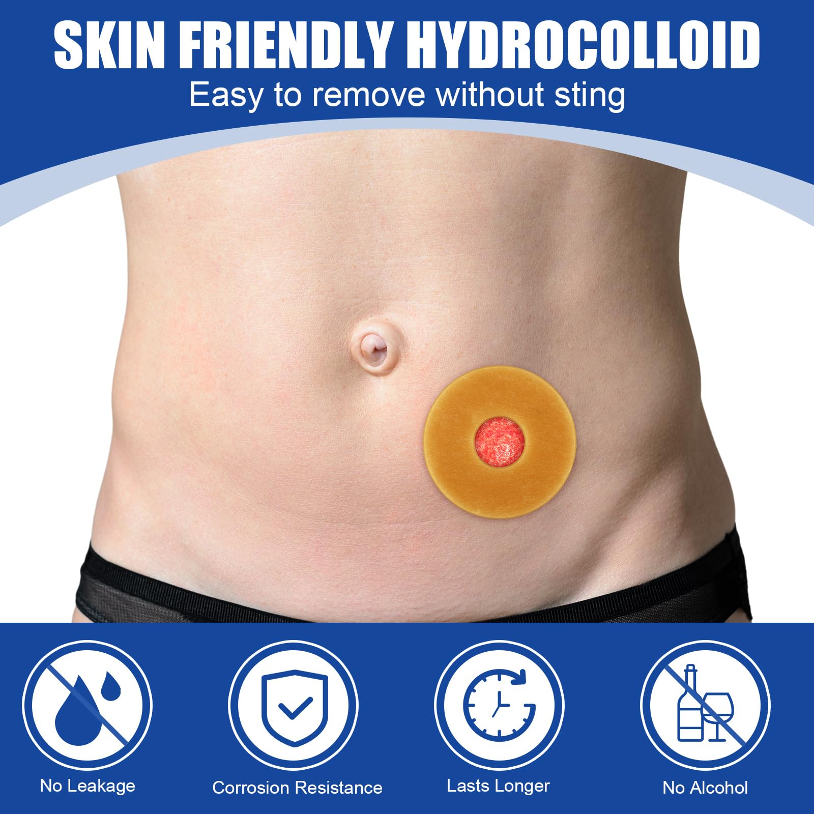 Siifert barrier rings compatible with all ostomy bag types and brands for versatility.