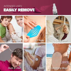 Skinister adhesive remover near CGM site supports clean, comfortable device transitions.
