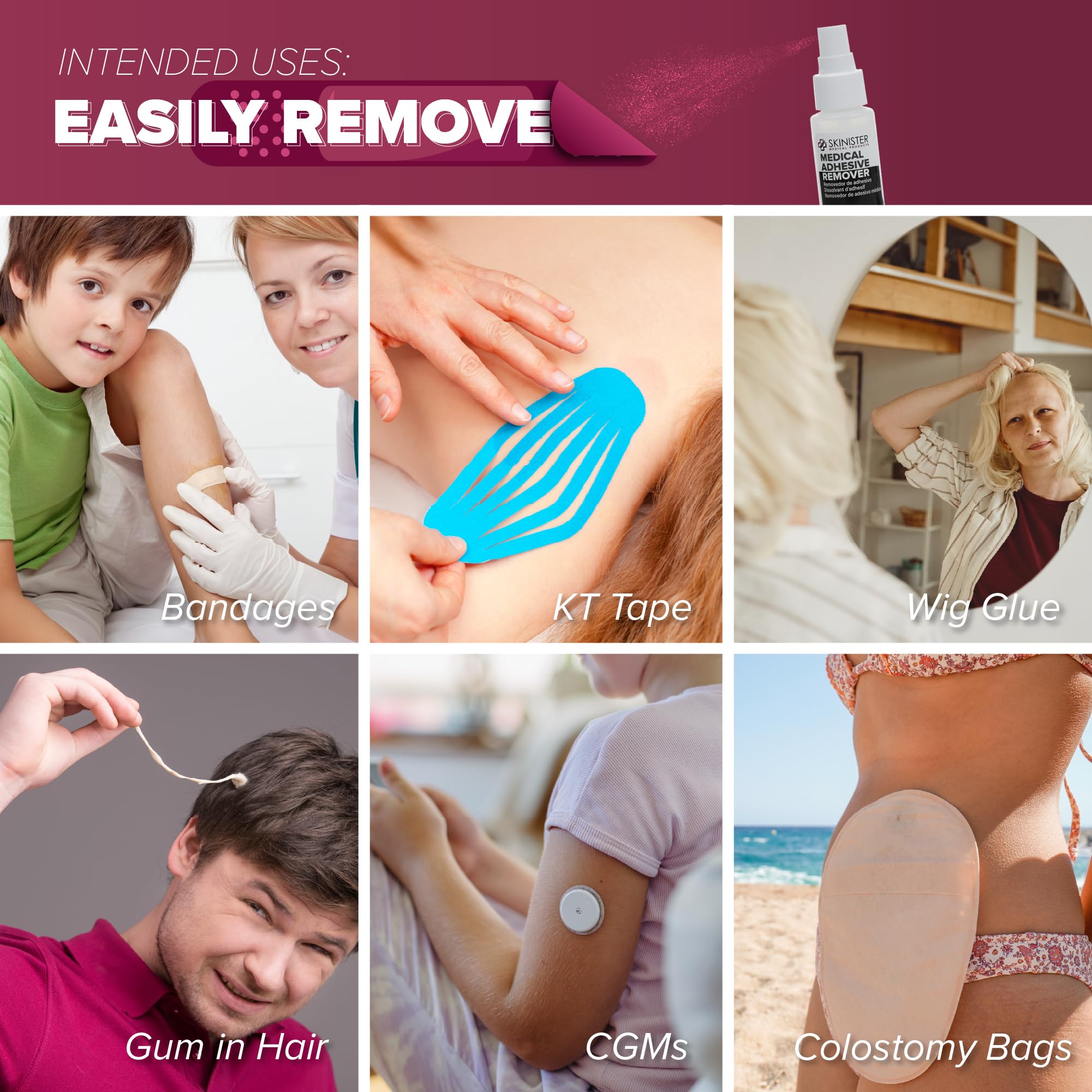 Skinister Adhesive Remover mist spray delivering fine coverage for removal