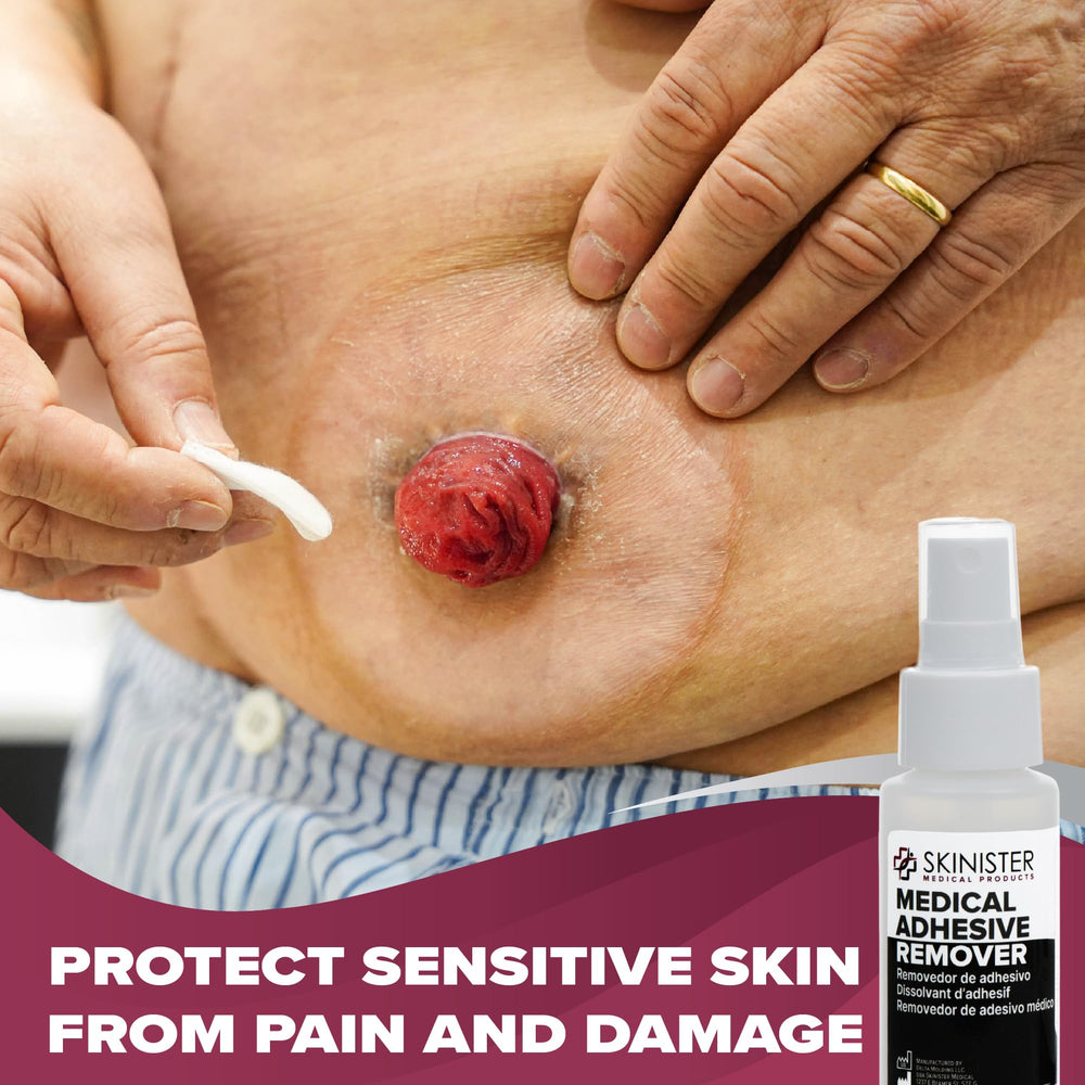Skinister sting-free adhesive remover provides smooth removal without irritation.