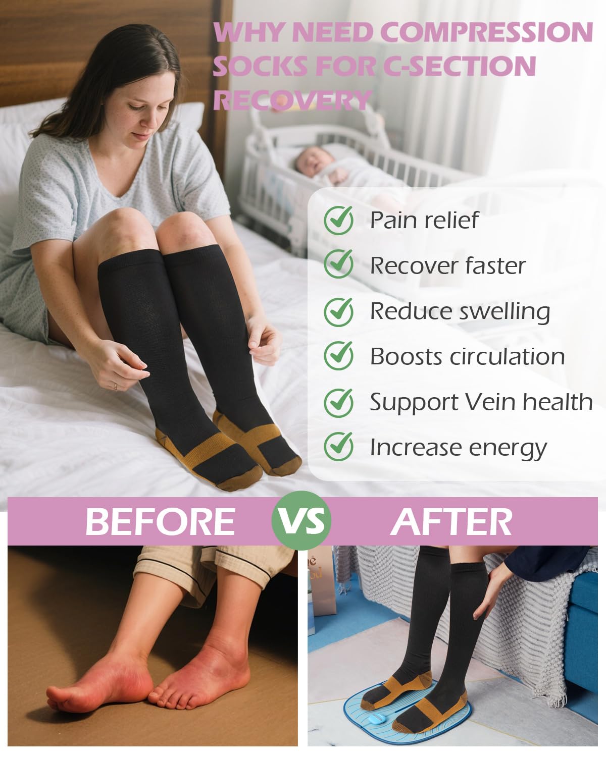 SOFTCA silicone scar sheets help improve scar appearance with breathable, lightweight material.