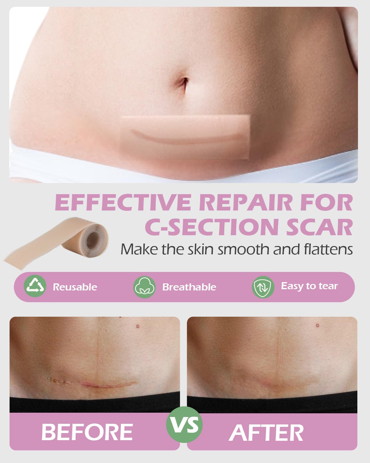 SOFTCA witch hazel pad liners delivering cooling, soothing relief for sensitive areas.