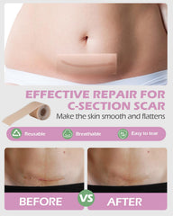 SOFTCA witch hazel pad liners delivering cooling, soothing relief for sensitive areas.