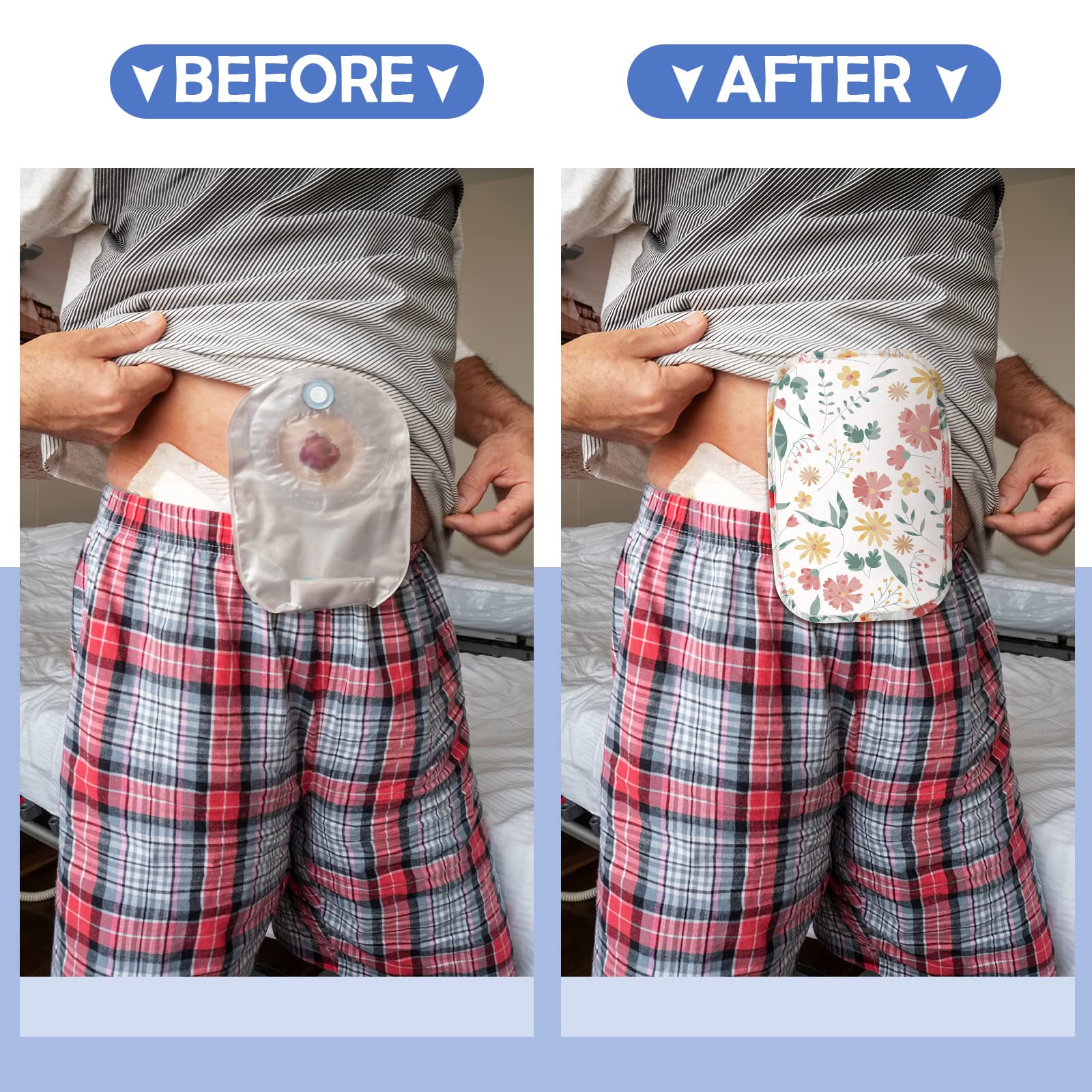 Sosation ostomy bag covers portable size for travel and quick changes.