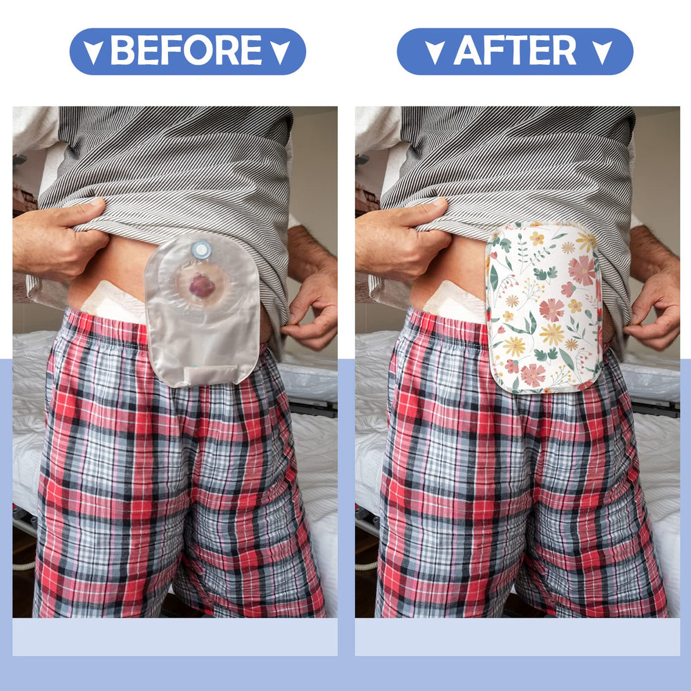Sosation ostomy bag covers portable size for travel and quick changes.