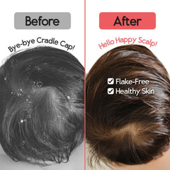 SplashEZ dual-texture brush offers soft daily soothing and firmer massage for stubborn flakes.