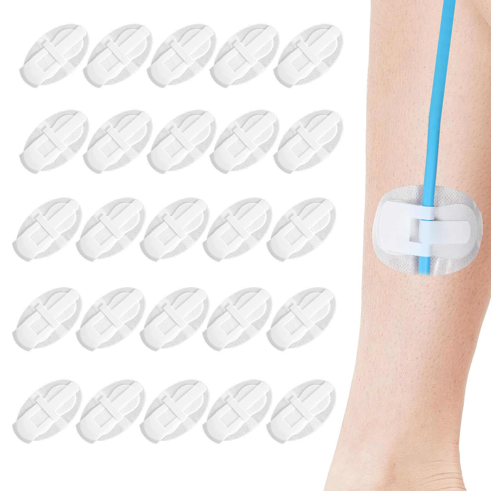 Telooco catheter fixation patch 11x6.5cm stabilizes a Foley setup with gentle support.