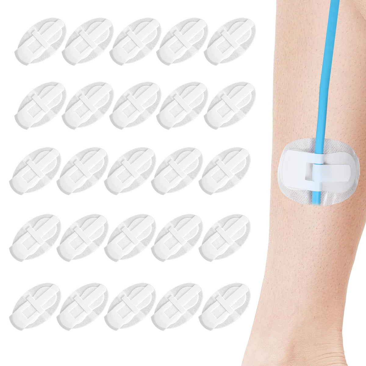 Telooco catheter fixation patch 11x6.5cm stabilizes a Foley setup with gentle support.