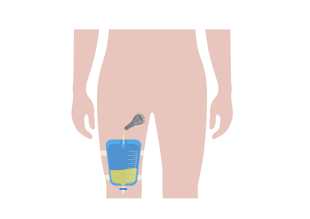 TOPMED ETS adhesive-strip attachment for quick and secure fitting