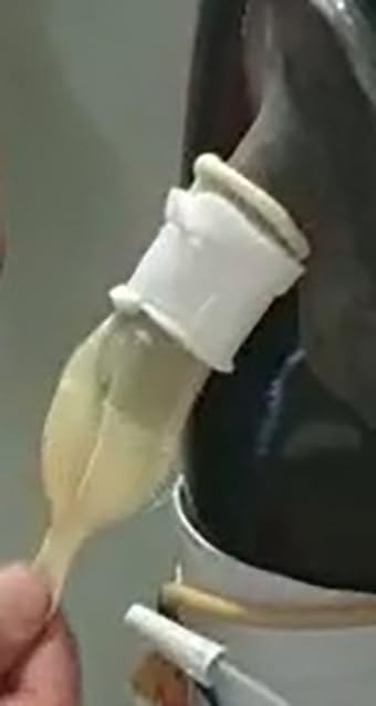 TOPMED ETS Male external catheter attachment holder stays in place with light stretch comfort.