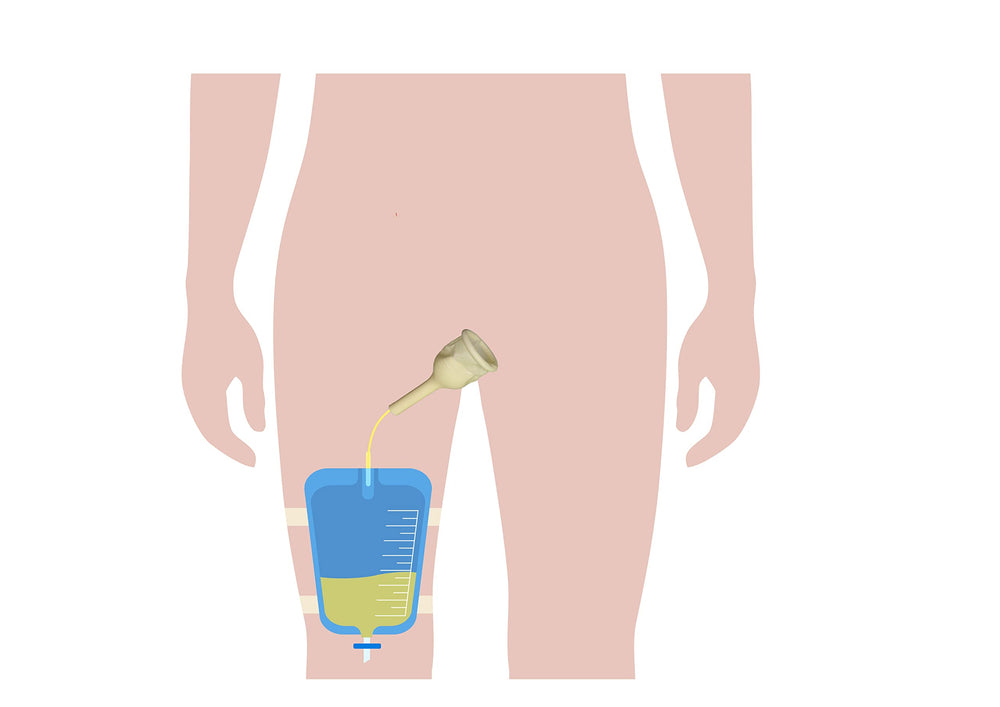 TOPMED ETS male external catheter kit used for everyday care