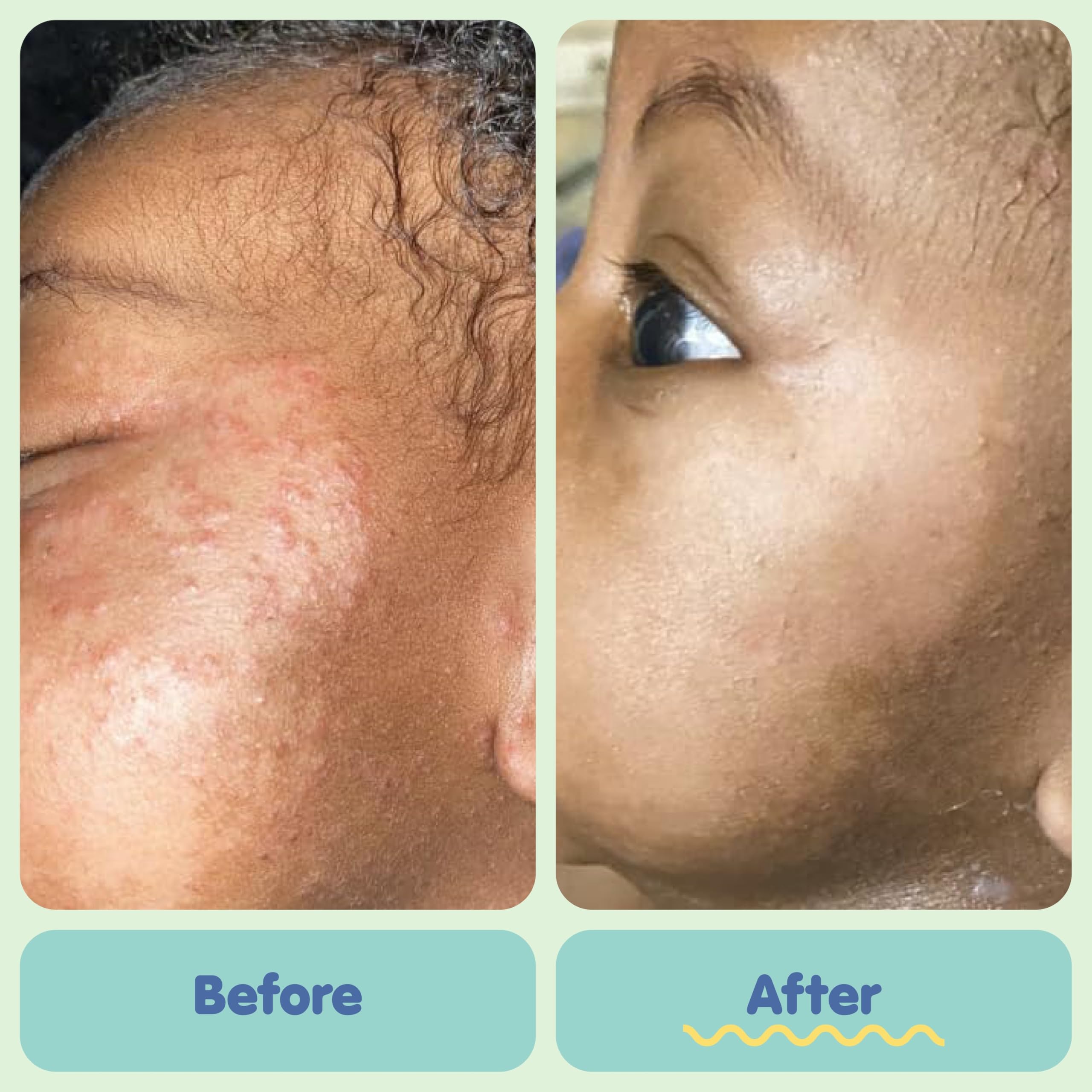 TUBBY TODD Colloidal oatmeal ointment at 1% helps soothe sensitive skin.