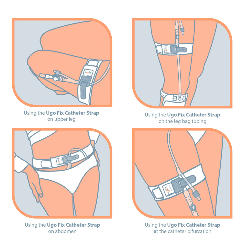 Ugo Fix Catheter Strap secures during activities like walking.