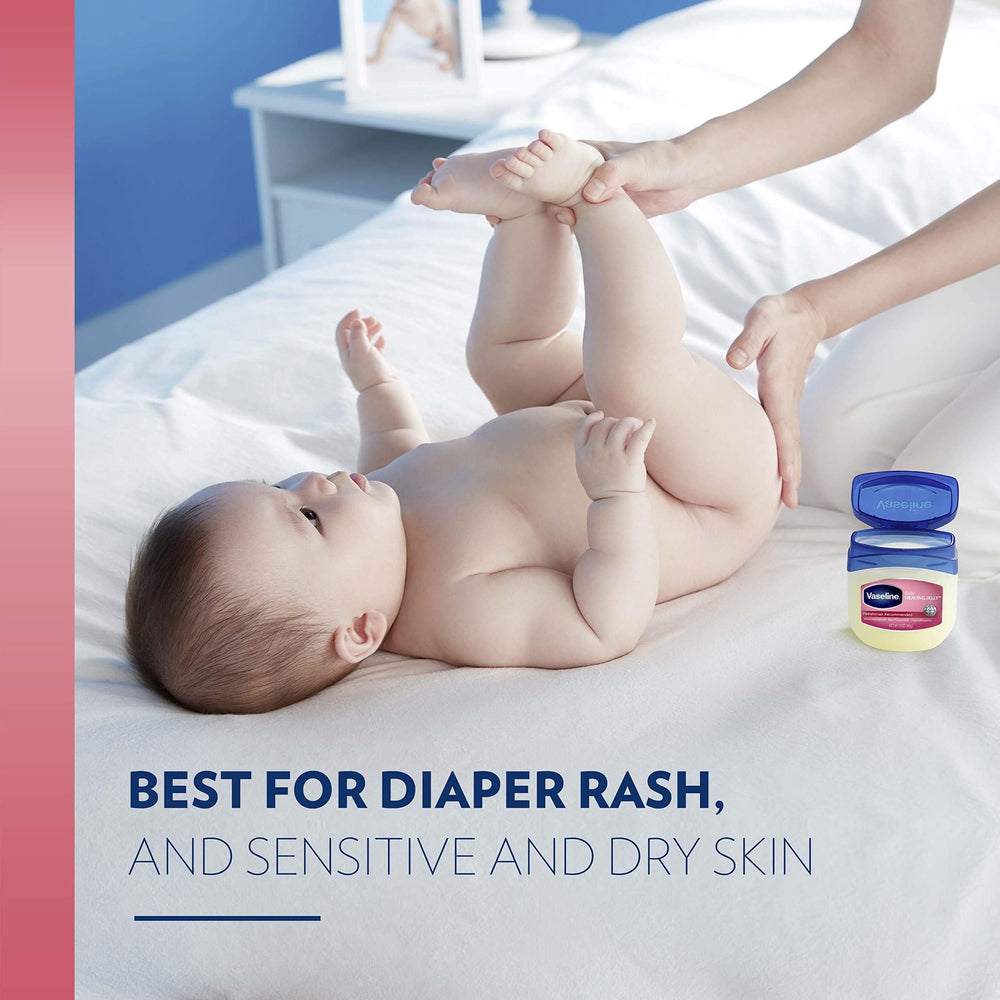Caregiver applying Vaseline Healing Jelly Baby to diaper area for protection.