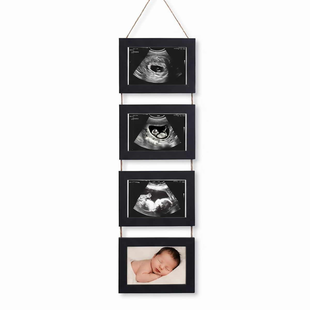 Vittqsuier 4-in-1 sonogram frame setup for organized ultrasound photo display.