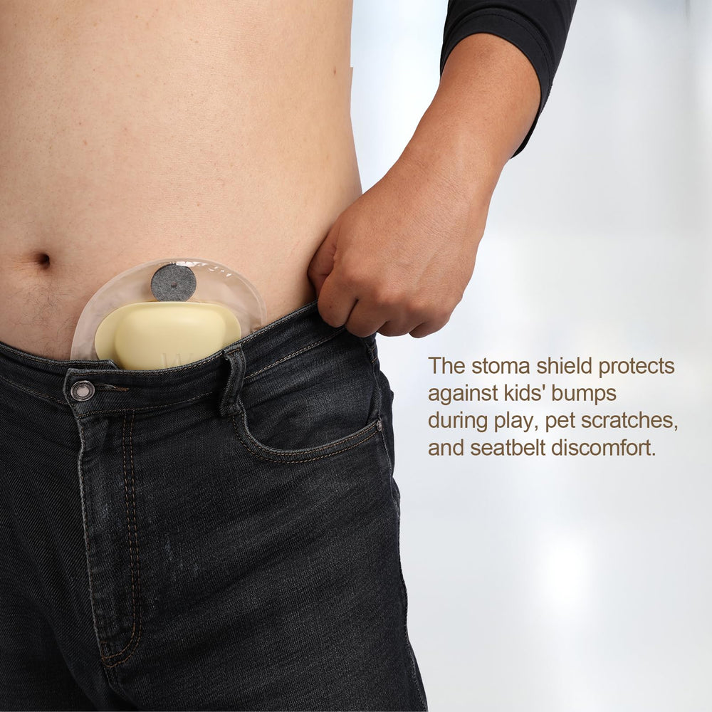 WansMed 50 sticker pairs pack provides quick reinforcement for ostomy bags.