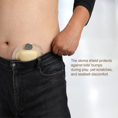 WansMed 50 sticker pairs pack provides quick reinforcement for ostomy bags.