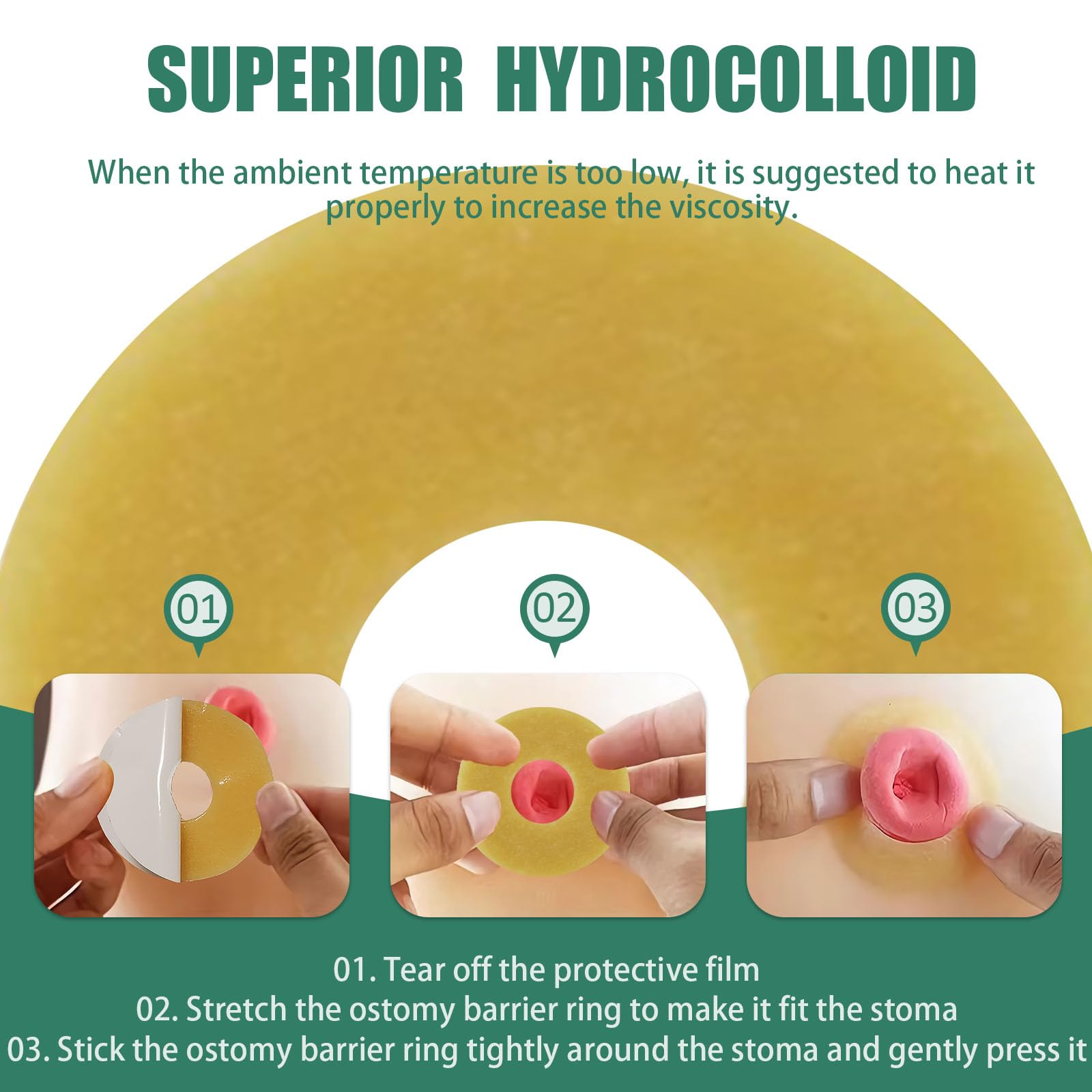 XIIFIIFII multi-ostomy compatibility closeup demonstrates use with various stoma types.