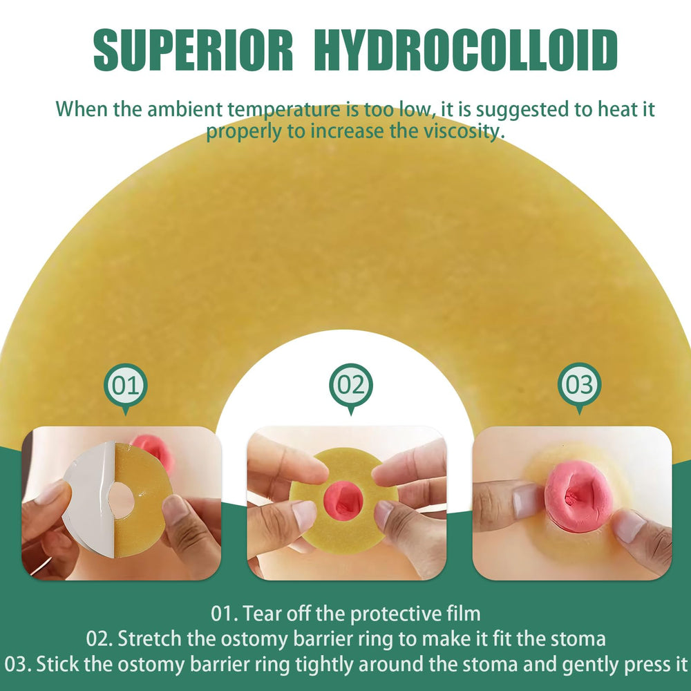 XIIFIIFII multi-ostomy compatibility closeup demonstrates use with various stoma types.