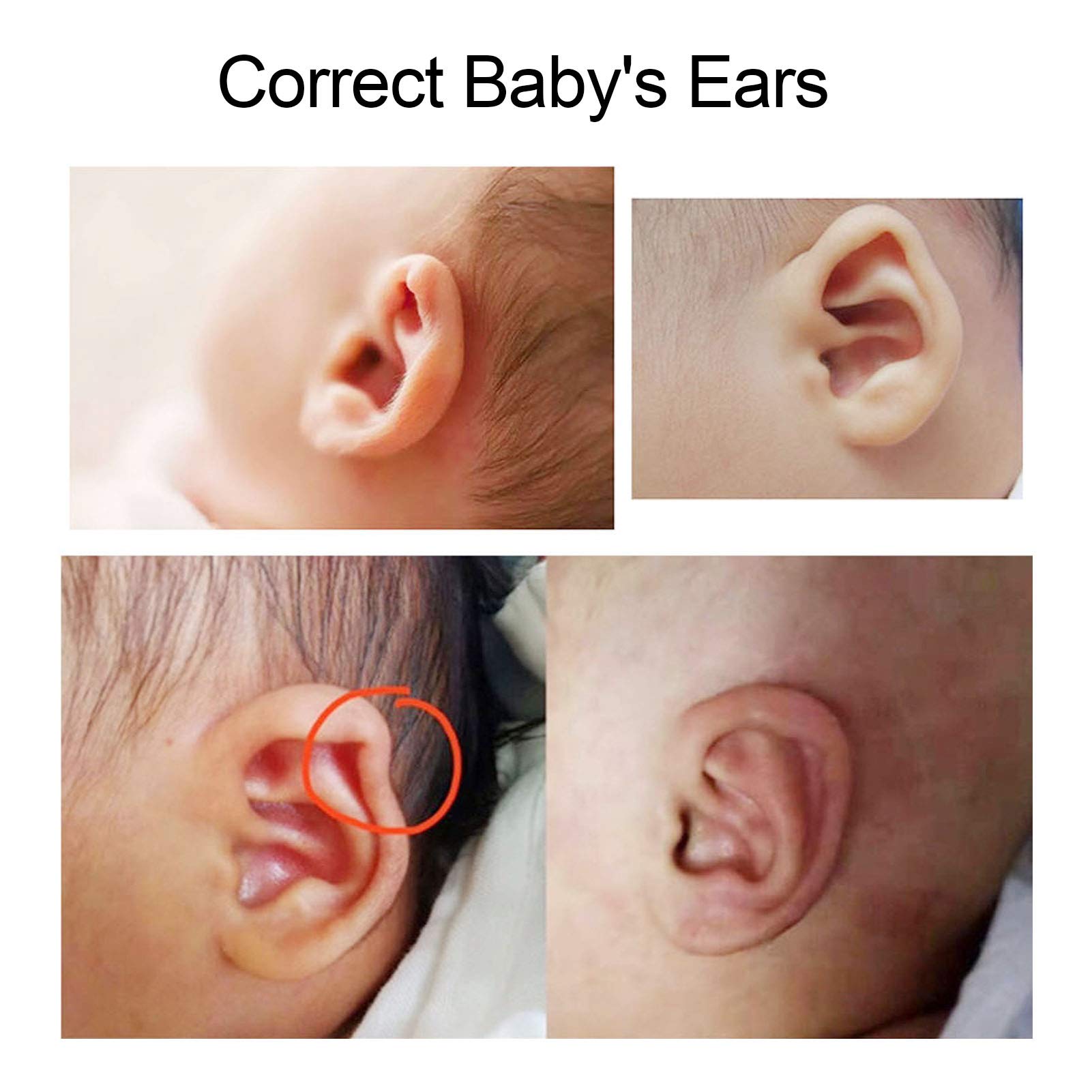 ZJchao self-cutting ear corrector stickers, customizable to fit baby ears.
