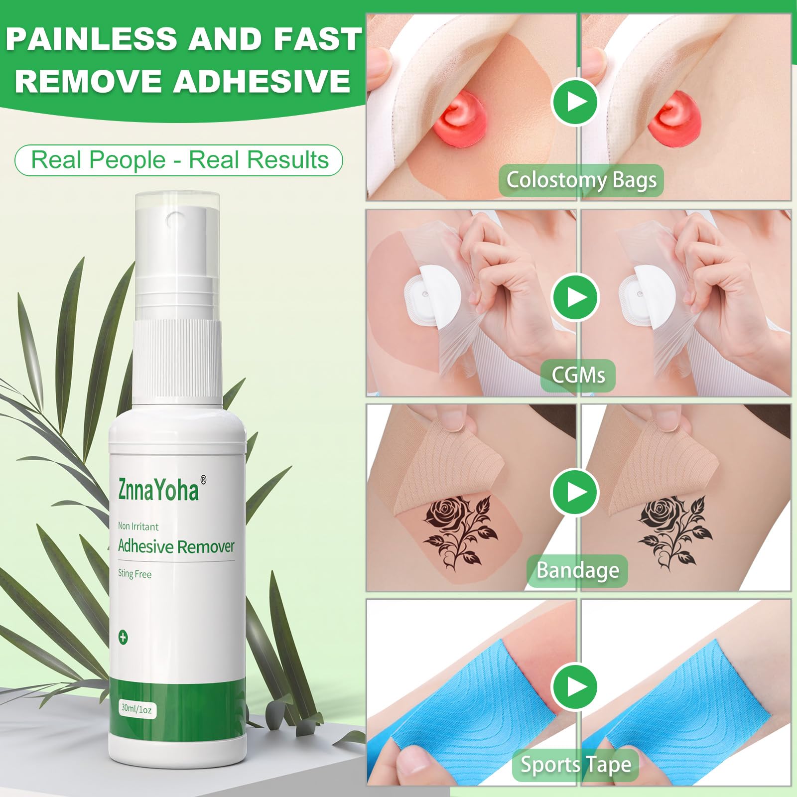 ZnnaYoha ostomy care scene demonstrates gentle adhesive lift