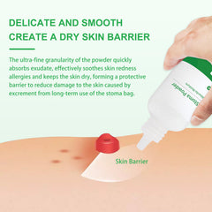 ZnnaYoha stoma powder on skin around stoma creates a dry, smooth surface.