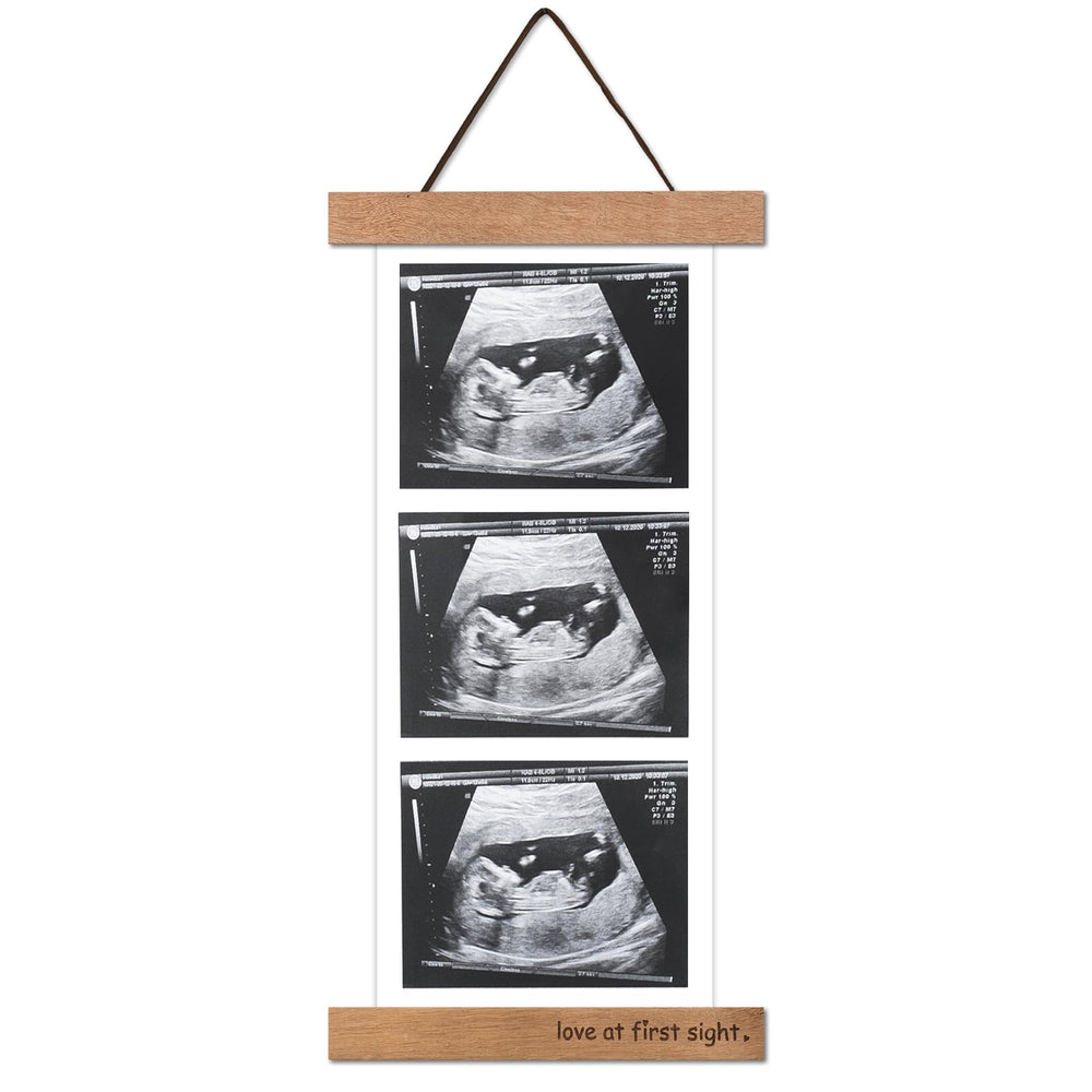 Zyeco wooden keepsake frame for ultrasound photos in nursery displays.