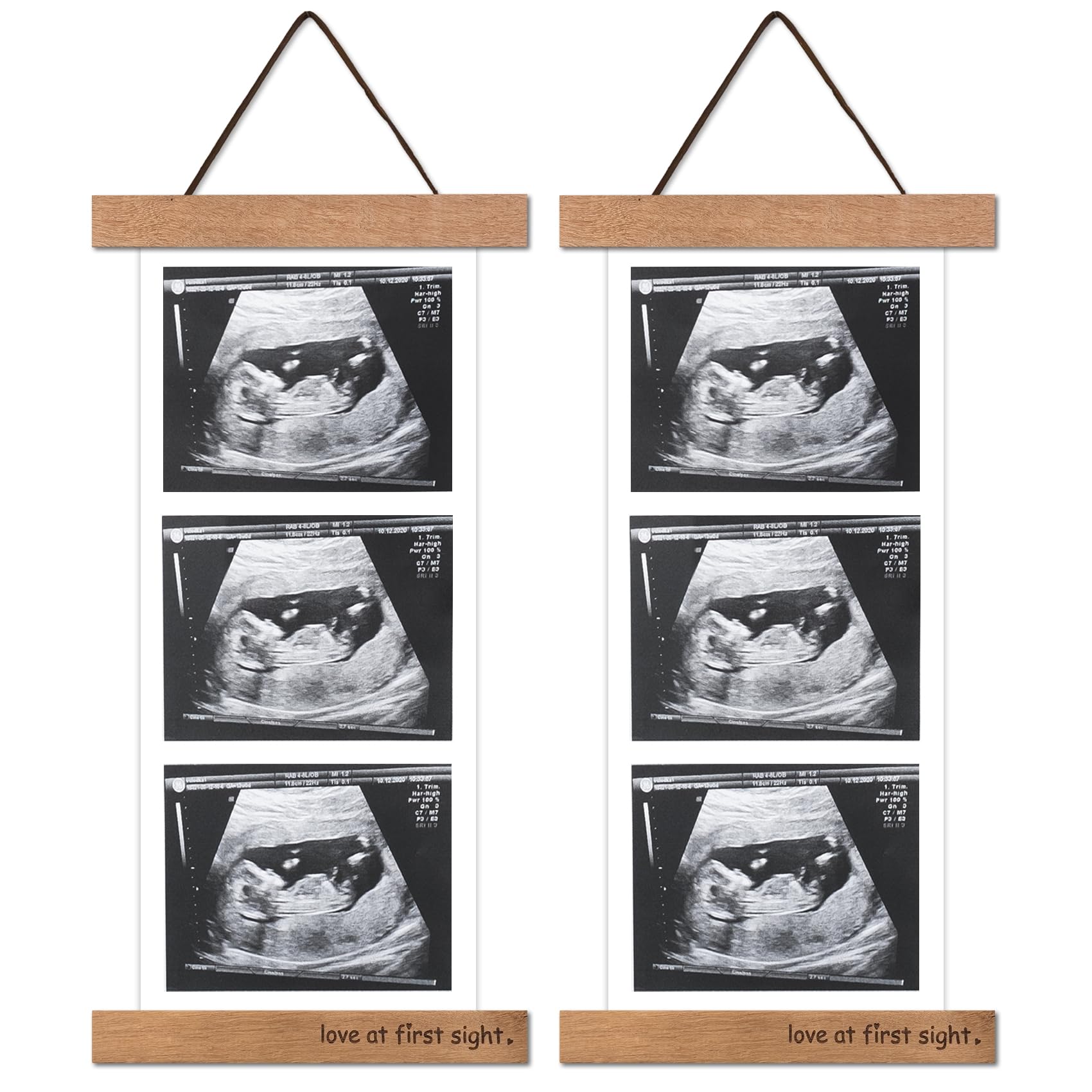 Zyeco wooden sonogram frame on fridge displays ultrasound photos neatly
