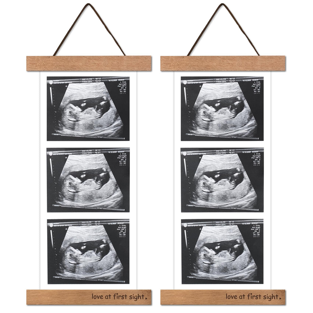 Zyeco wooden sonogram frame on fridge displays ultrasound photos neatly